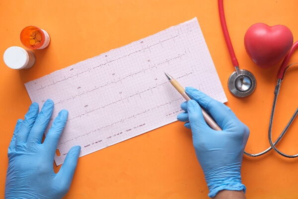 Zdravnik pregleduje zapis EKG-ja bolnika z atrijsko fibrilacijo.