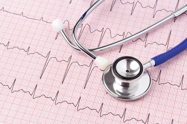 natisnjen izvid EKG-ja in stetoskop